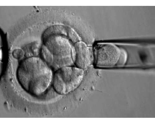 育儿嫂中介公司_育儿小知识每日分享,东莞助孕试管婴儿前的身体检查很重要吗