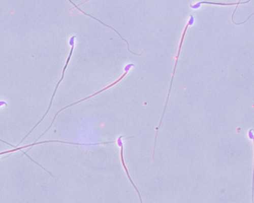 圆梦助孕公司在哪|广州供卵试管包男孩要花多少钱?附详细流程?