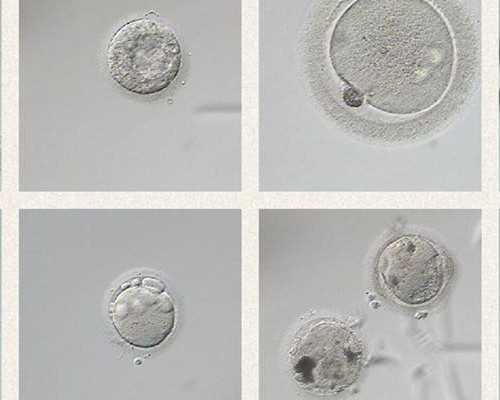 怀孕3个月胎儿大小-供卵试管助孕