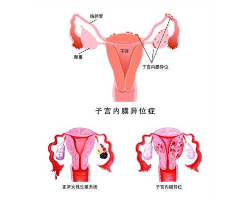 在找供卵不排队_供卵怀孕公司,2026
乌海市妇幼保健院供卵试管费用明细表，附