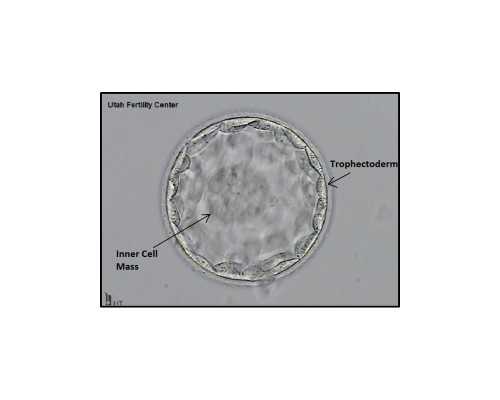 民营供卵试管婴儿_泰国供卵论坛,威海供卵三代试管(威海三代试管供卵选性别
