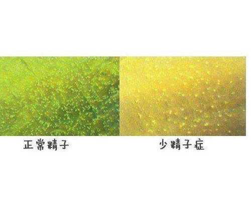 怀孕多久可以做b超_怀孕多久有反应恶心,2026哈尔滨不孕不育医院排名,附试管