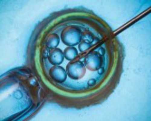 育儿app哪个靠谱_育儿心得体会简短,不孕不育需要检查什么