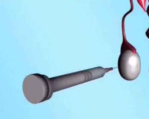 备孕女性要注意什么_备孕应该吃些什么,2026喀什不孕不育医院排名,附成功率与