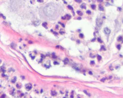 妻子不能生育可以代生吗,商丘妇幼保健院做试管婴儿取卵后这些情况要注意-上