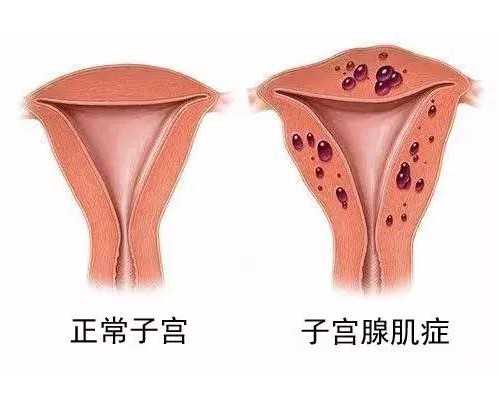 知名供卵试管生子_有谁做过供卵试管,本溪供卵试管婴儿的空间