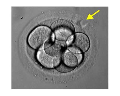 160斤做试管婴儿成功有吗-私人助孕公司