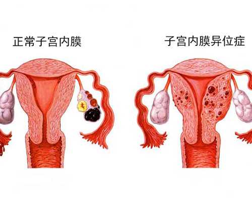 怎么代生,美国试管婴儿包生儿子吗？-为什么试管移植后时有姨妈感时又没有