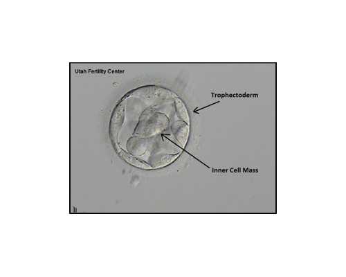 呼和浩特代怀流程,呼和浩特供卵试管微信群_试管助孕生子助孕机构