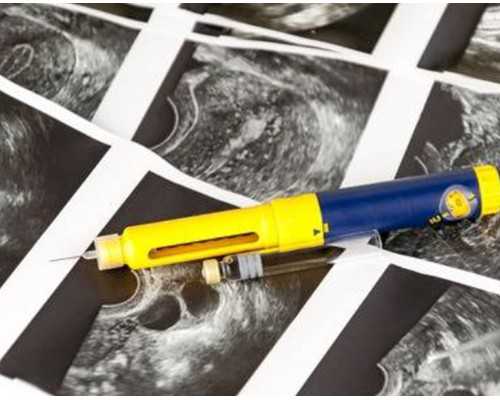 郑州代生代怀,试管婴儿移植后肚子疼怎么回事？-上海供卵试管公司有哪些-30