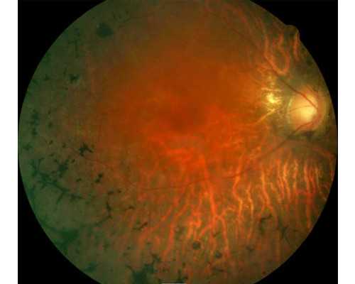 北京试管代生机构,泰国试管婴儿移植前，如何科学有效提高成功率？-马鞍状子