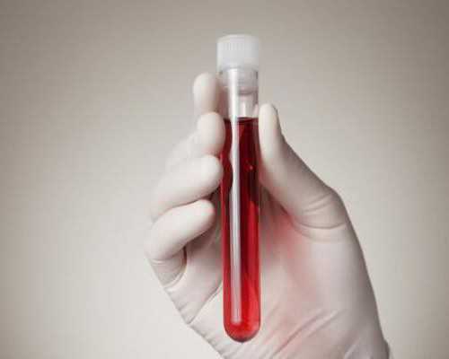 怀孕期间可以同房吗_育儿教育书籍,吃什么能给孕期的宝宝补营养