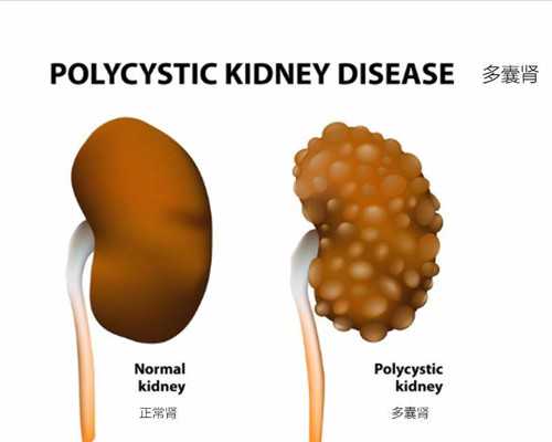 广州代生代怀,2026北京供卵医院试管婴儿多少钱?-2026年兔宝宝四月生男生女-试管