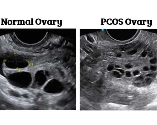 广州试管代生机构包男孩,试管婴儿的步骤是体外受精以及胚胎移植，那应该属