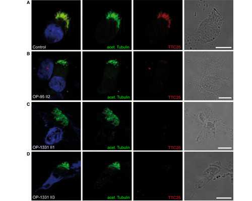 呼和浩特供卵试管医院排名,呼和浩特42岁卵巢早衰试管成功,专业知识带你正确