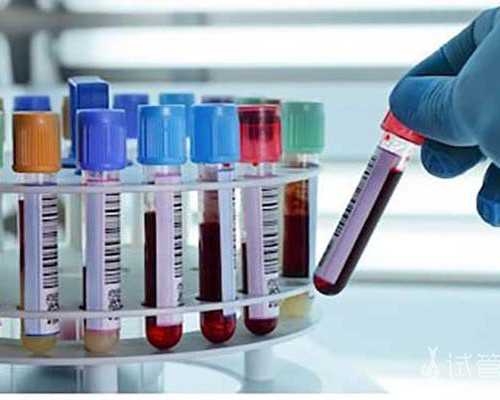 有代生孩子的妈,赴美做试管婴儿取卵后要休息多久,头晕恶心正常吗?-取卵会