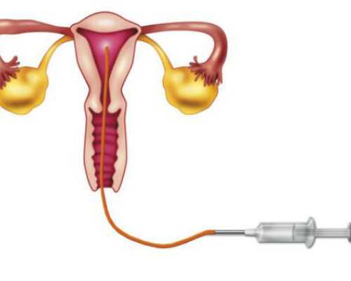 帮别人代生为法吗,北京私立试管包成功医院排名-上海供卵试管生子多少钱_克氏