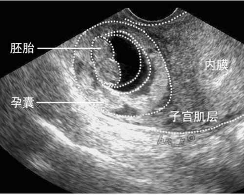 供卵如何防止被骗_供卵生殖医院,【天津供卵机构卵巢早衰做供卵】我怀儿子的