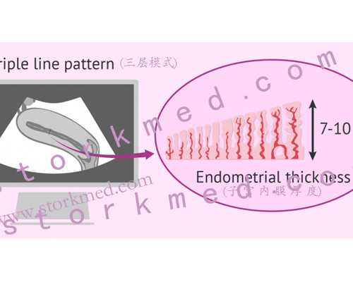 宫外孕腹腔镜手术后多久可以怀孕-代怀孕产子