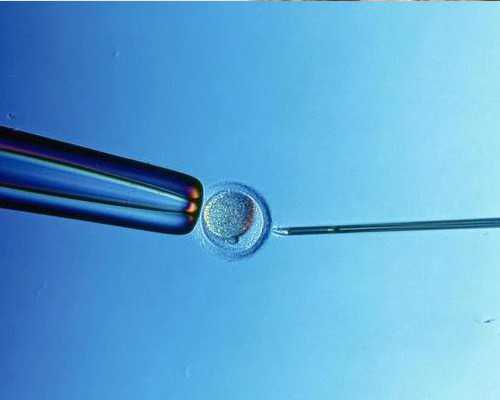 地下供卵试管电话_最大的供卵机构,天津2026
供卵机构排名已发布!附供卵生男