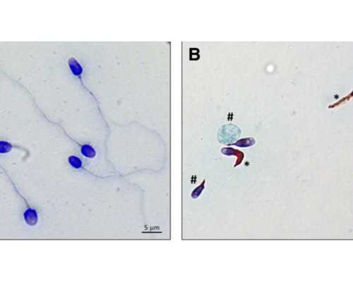 绝经后的女性可以做试管婴儿吗?-代怀电话