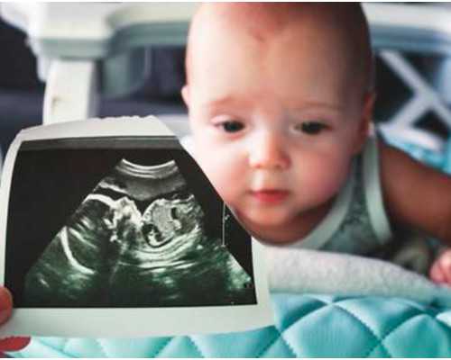 移植胚胎后睡眠质量就变差了是怎么回事?-代生费用