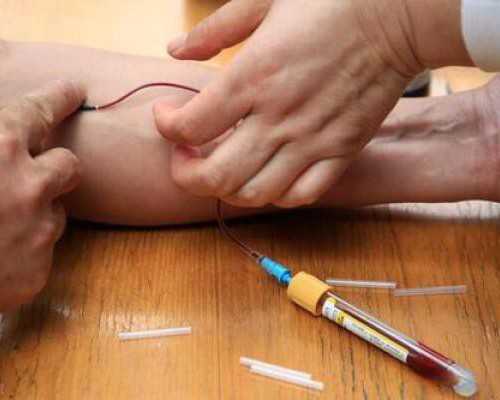 宫颈息肉会腰疼吗-高龄试管代怀