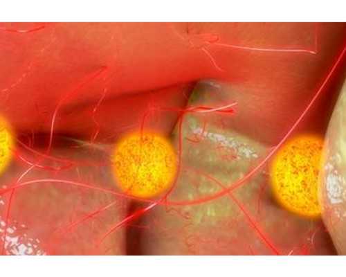 备孕女性应该怎么做_怀孕一个月的症状,备孕路上的拦路虎多囊卵巢该这么治?