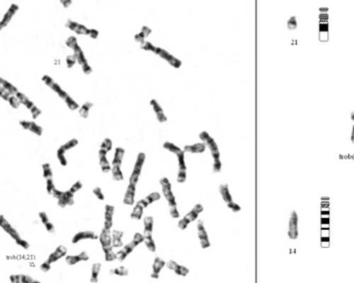 药流后宫腔粘连怎么办？有什么症状？-代生小孩费用
